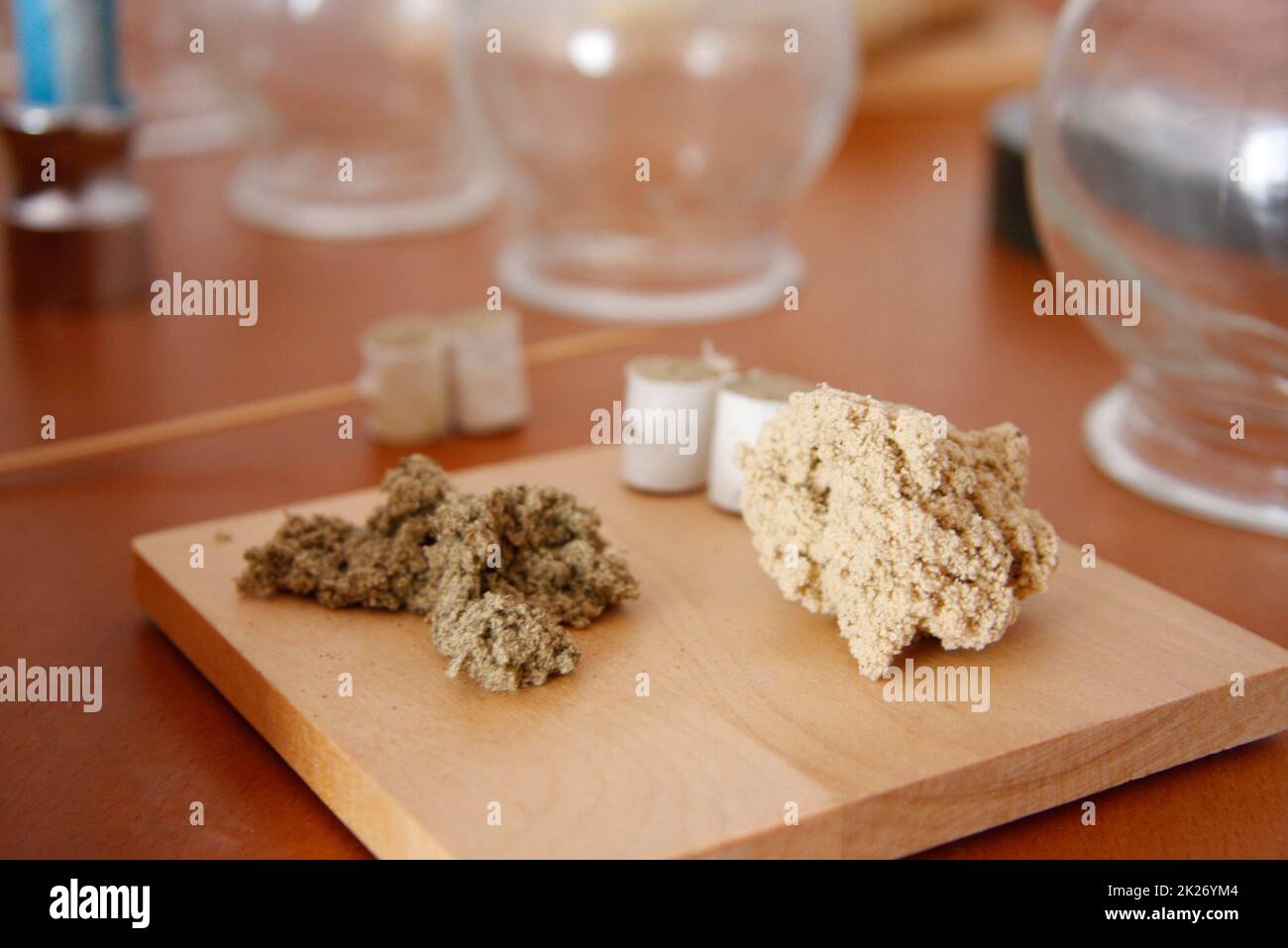 Frau entspannt sich von Akupunktur Verfahren. Ein Akupunkturist doong Akupunktur sehr genau. Traditionelle chinesische Medizin Stockfoto