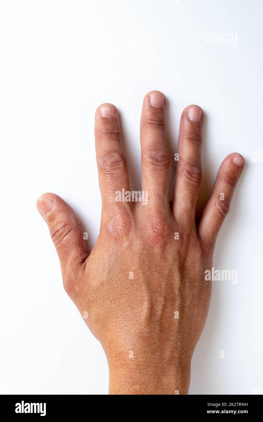 Zehen, Hände und Nägel. Männliche menschliche Körperteile im Alter von 20 bis 30 Jahren Stockfoto