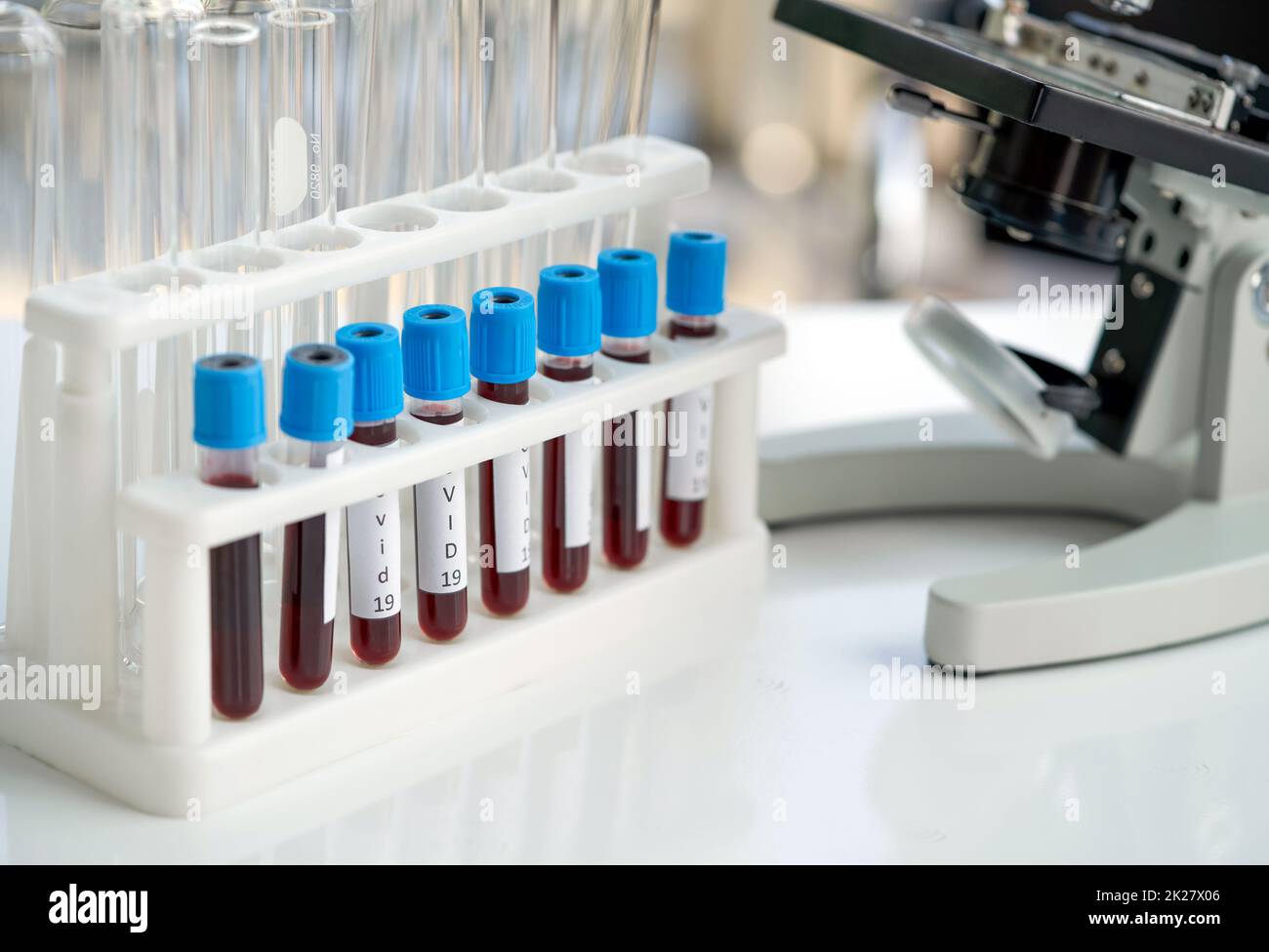 Blutentnahmeröhrchen von Covid 19-Patienten neben dem Mikroskop auf dem weißen Labortisch platzieren. Coronavirus Disease 2019 Testverfahren in einem Labor, das die Verbreitung der Virusforschung verhindert. Stockfoto