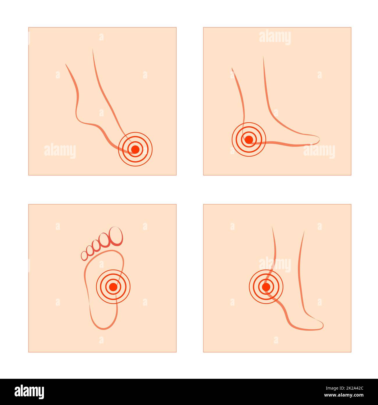 Flaches Design eines Gesundheitskonzeptes, Schmerzen und Verletzungen in Körperteilen. Frau fühlt Schmerzen in Fuß, Knöchel und Zehen. Stockfoto