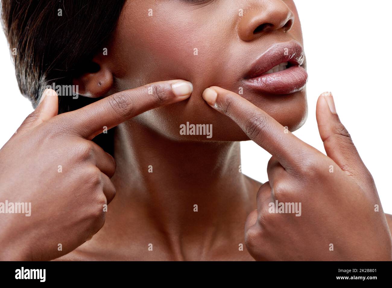 Das sieht nicht gut aus. Nahaufnahme einer jungen Frau, die einen Noppen quetscht. Stockfoto