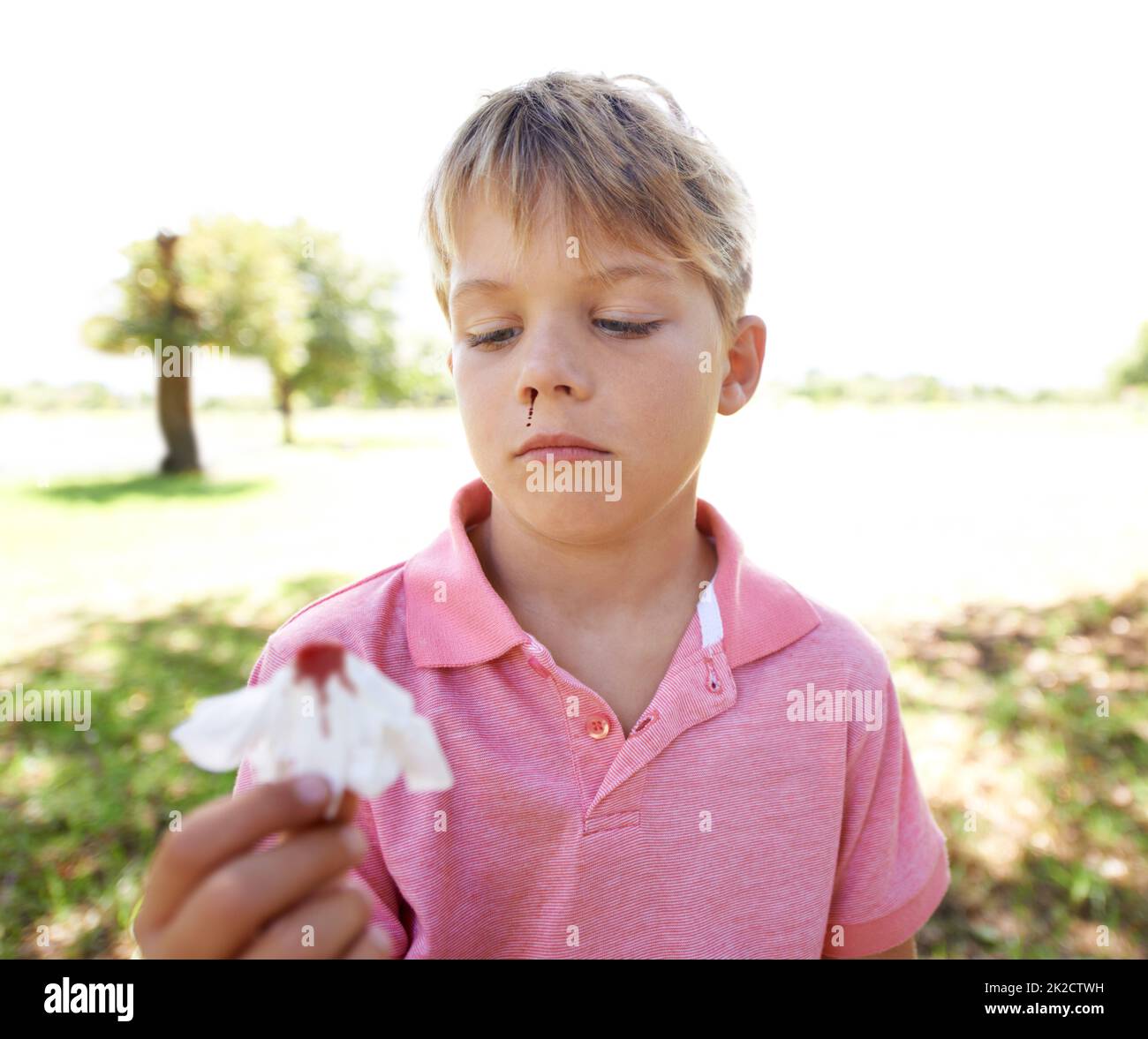 Jungen werden Jungen sein. Ein kleiner Junge mit einem Nasenbluten, der draußen steht. Stockfoto