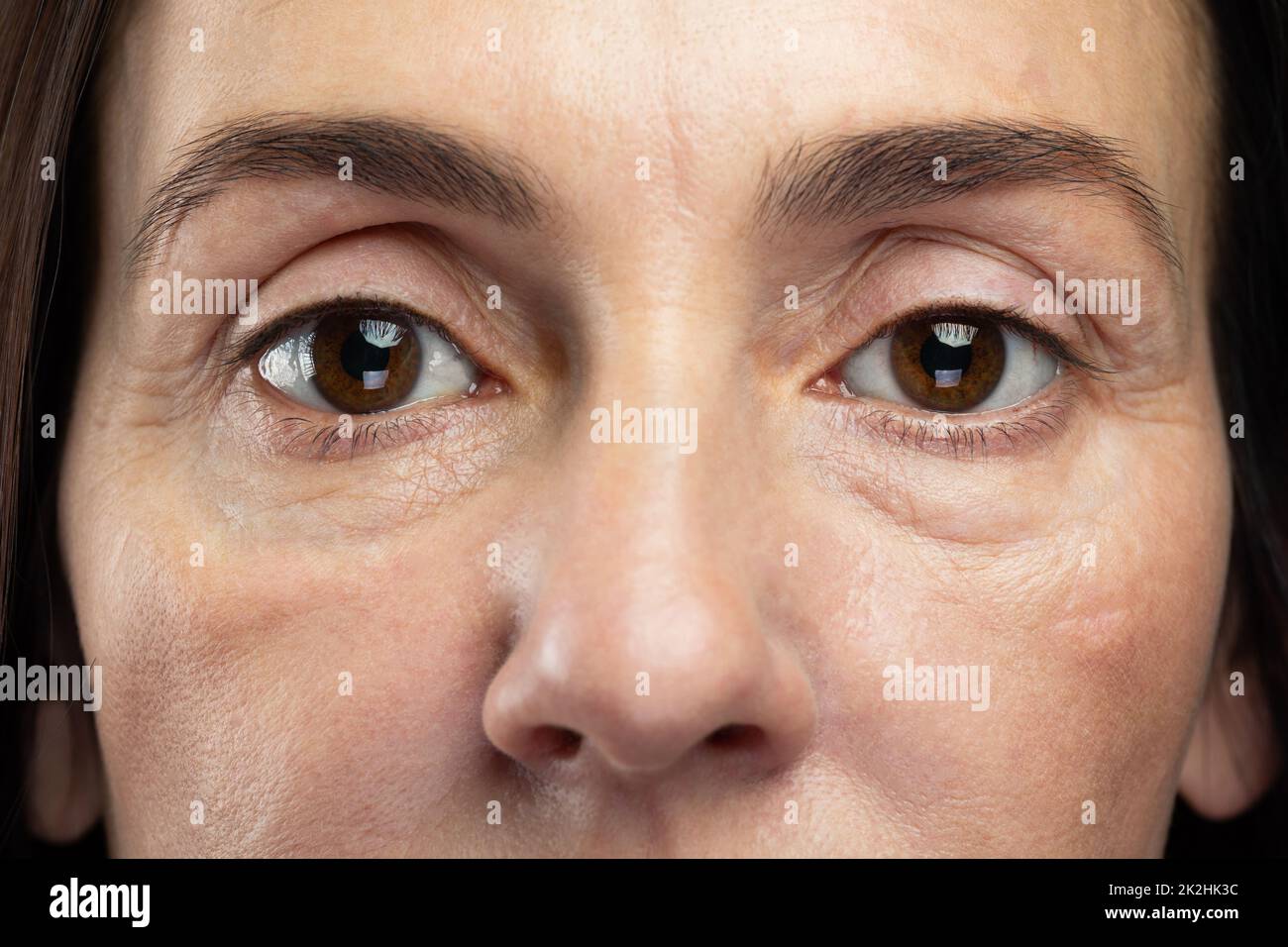 Müde Augen einer Frau mittleren Alters Stockfoto