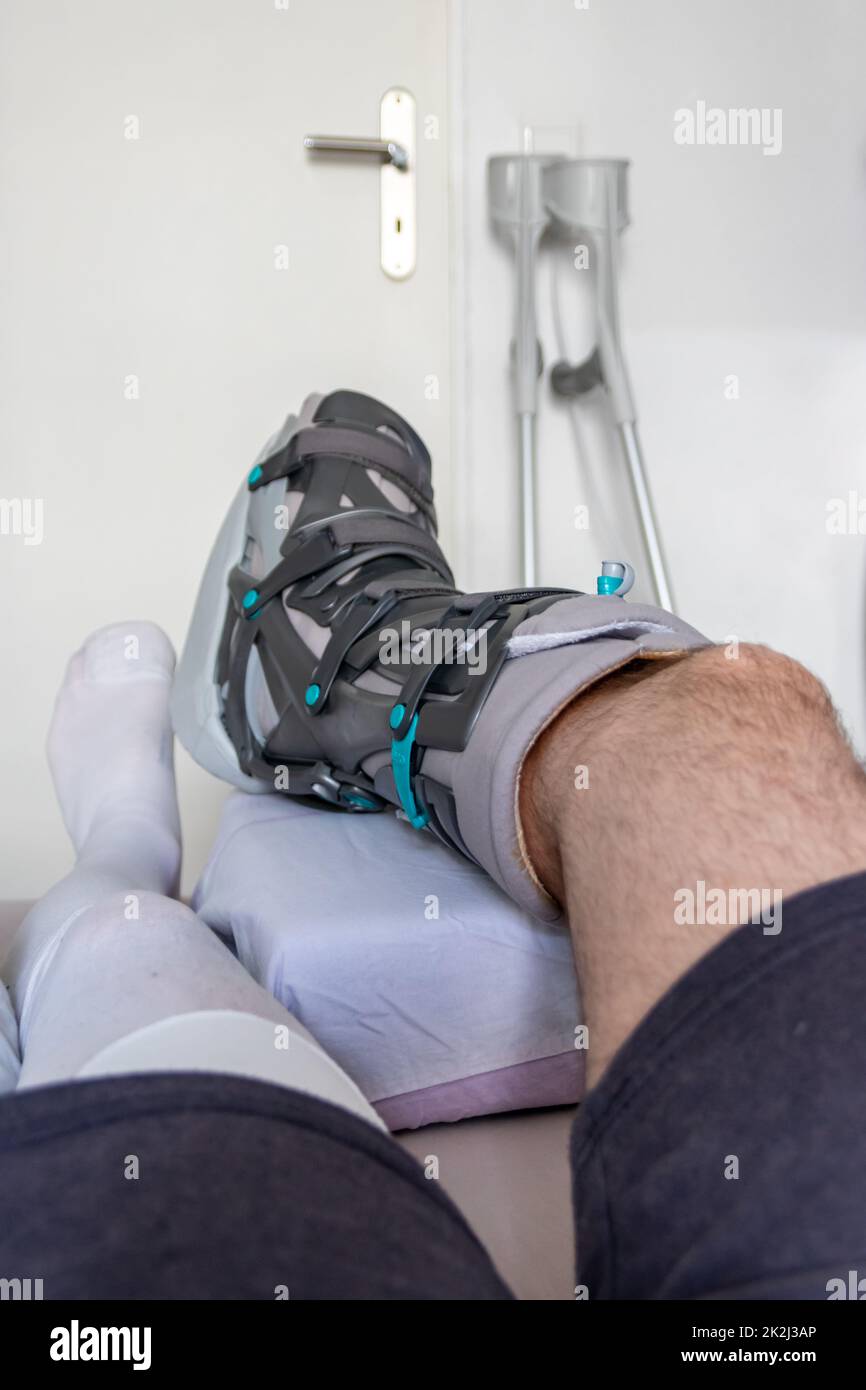 Gips bein krücken -Fotos und -Bildmaterial in hoher Auflösung – Alamy