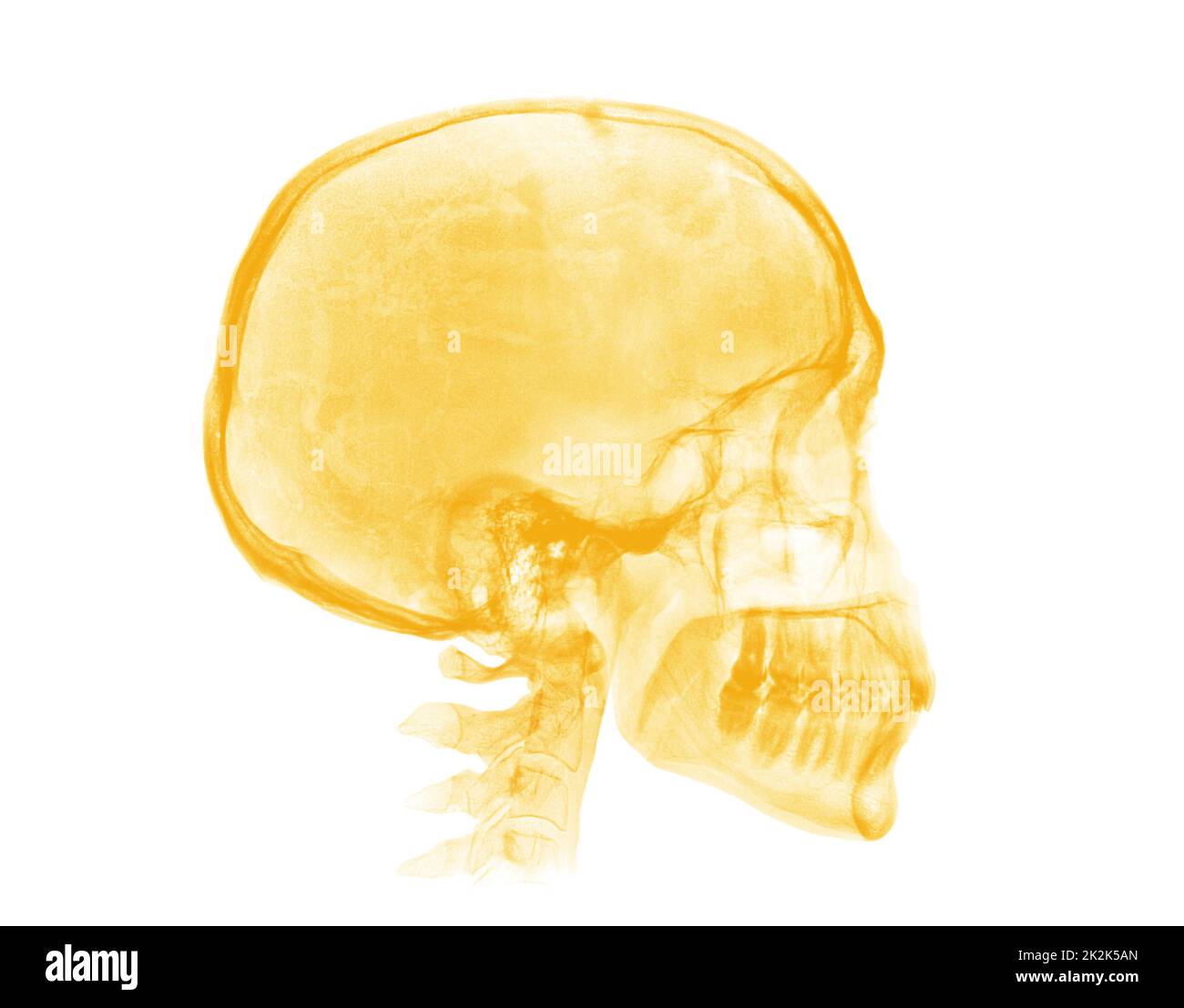 Menschlicher Schädel. Gelbes Röntgenbild auf weißem Hintergrund Stockfoto