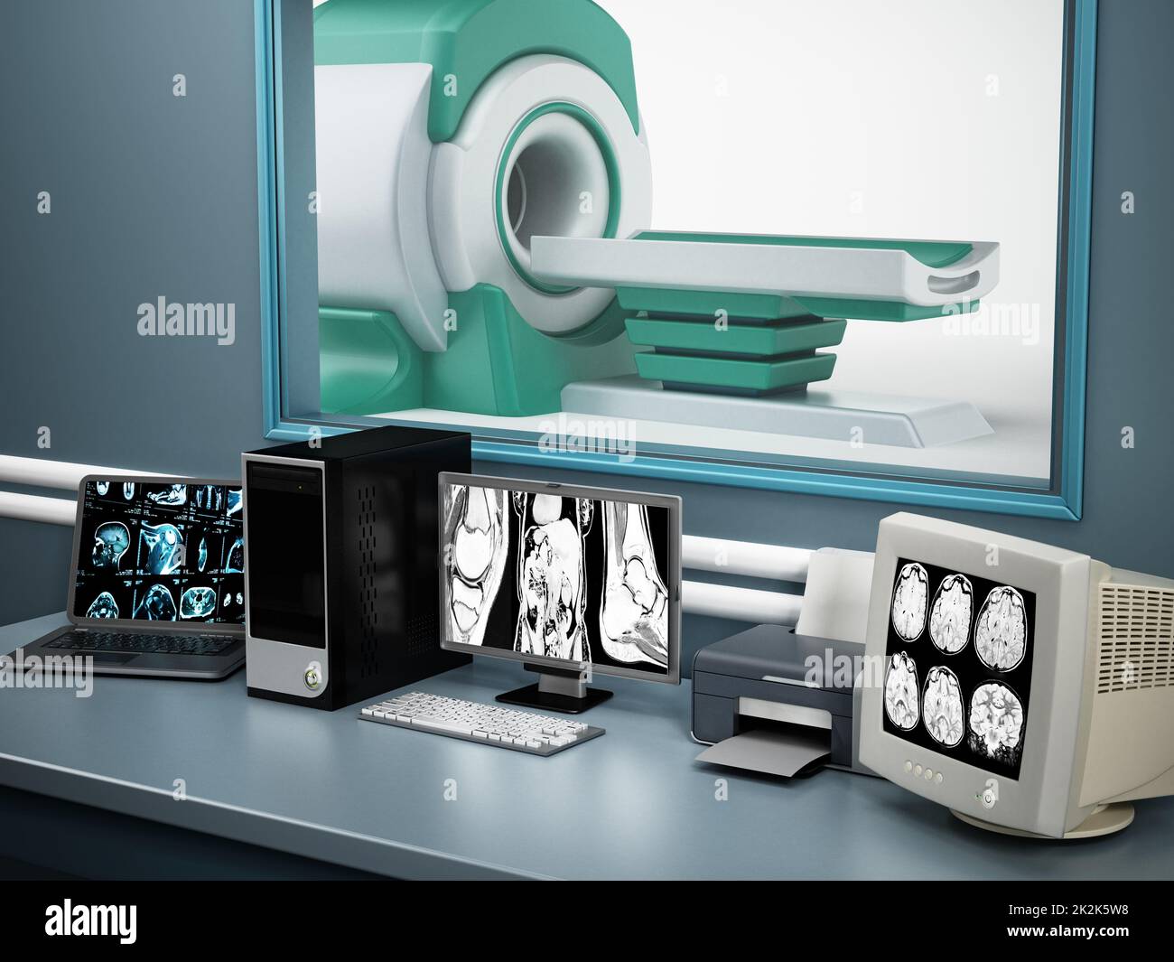 Magnetresonanztomographie-MRT-Gerät und Computersysteme Stockfoto