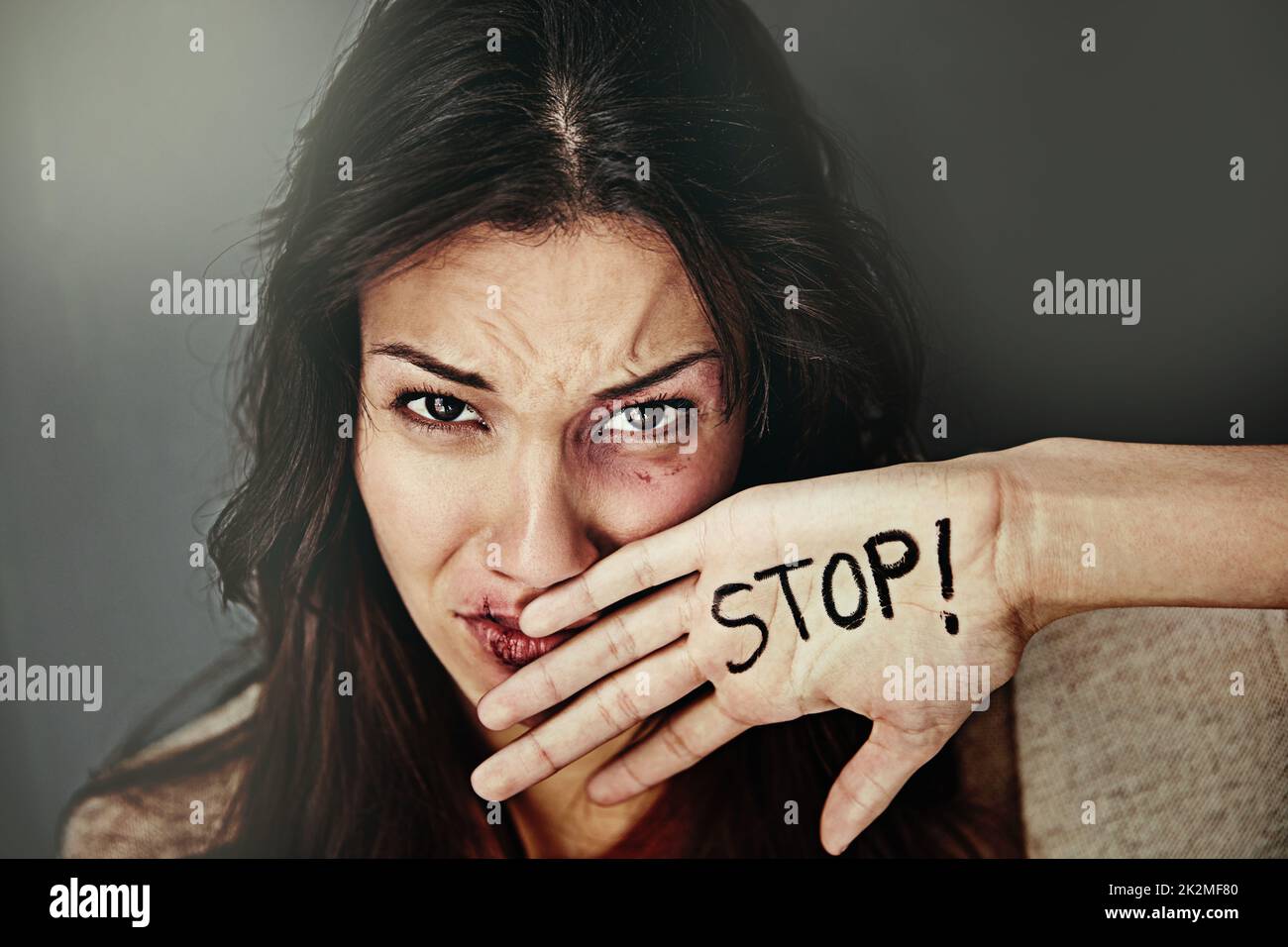 Es ist an der Zeit, dem häuslichen Missbrauch ein Ende zu setzen. Porträt einer verprügelten und gequetschten jungen Frau mit dem Wort STOP auf der Hand. Stockfoto