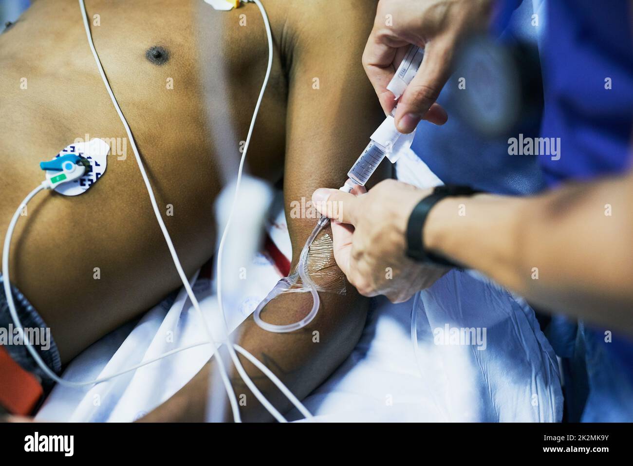 Medikamentengabe über einen i.v. Tropf. Zugeschnittenes Bild eines Arztes, der einen infusionstropfen in einen Patientenarm in einer Notaufnahme einführt. Stockfoto