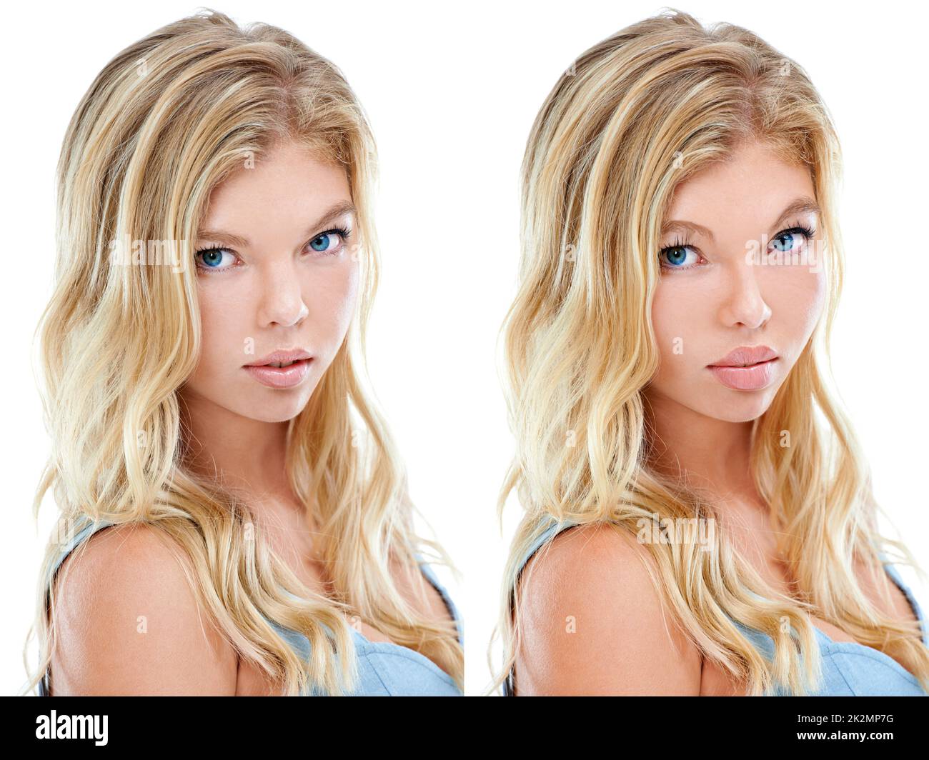 Wer sagte, Schönheit kann nicht gekauft werden. Komparatives Komposit-Bild einer jungen Frau vor und nach der plastischen Operation. Stockfoto