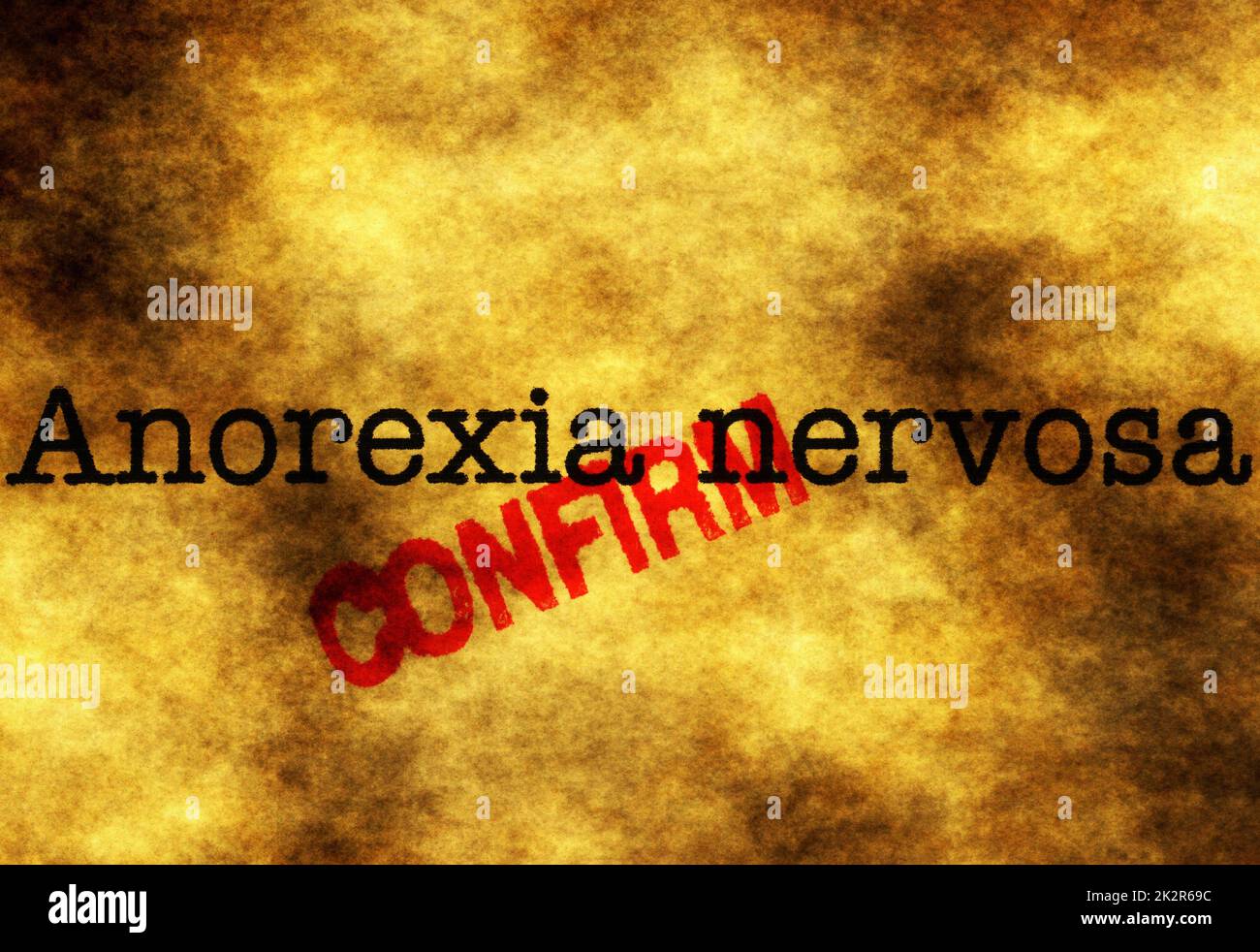 Anorexia Nervosa bestätigen Stockfoto