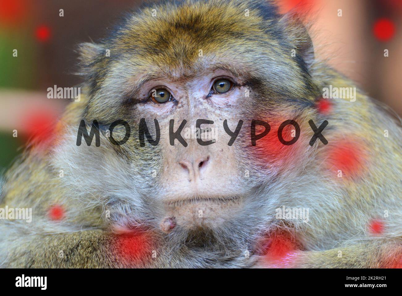 Monkeypox-Ausbruch, MPXV-Virus, sich ausbreitende Infektionskrankheiten, kranker Affe Stockfoto