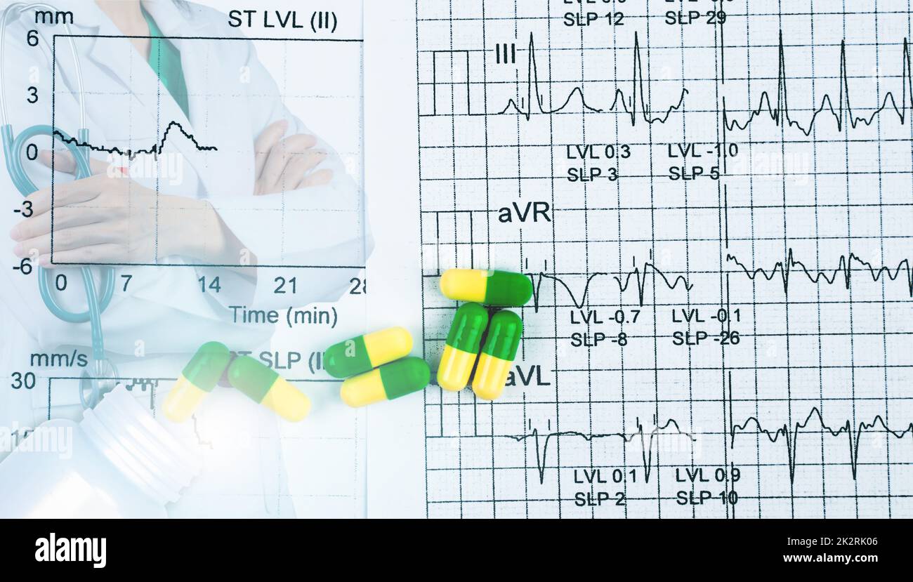 EKG- oder EKG-Berichtspapier. EST-Ergebnis und grün-gelbe Kapseln Pillen mit Kardiologen Facharzt tragen weiße Uniform. Arztstand mit gekreuzten Armen und Handstethoskop. Stockfoto