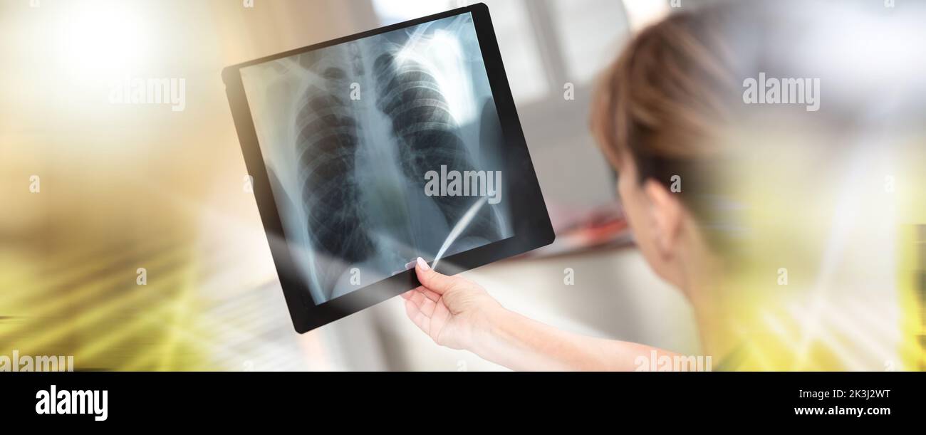 Ärztin, die Röntgenbericht in der Arztpraxis untersucht; Mehrfachexposition Stockfoto