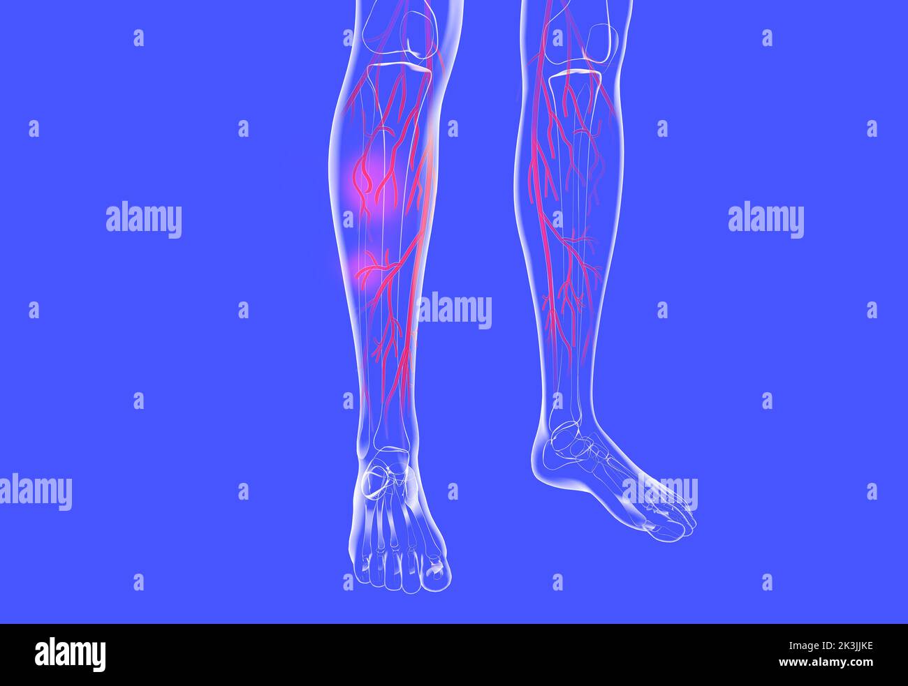 Transparente anatomische 3D Darstellung der menschlichen Beine. Zeigt das Venensystem mit Krampfadern und Ekzemen. Stockfoto