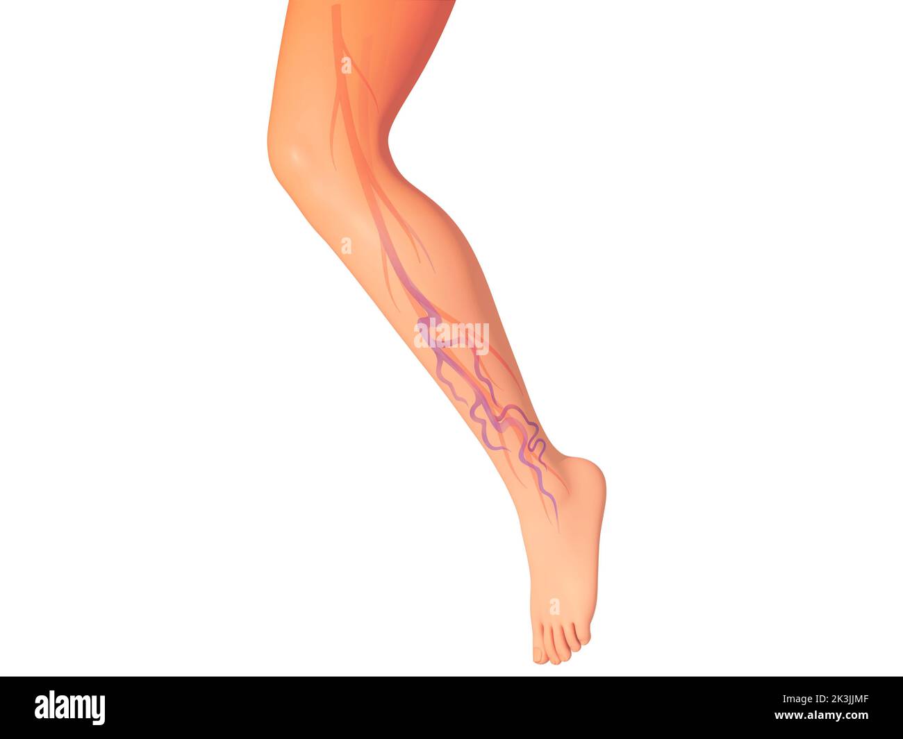 3D Darstellung des Venensystems mit Krampfadern in einem Bein. Realistische anatomische Darstellung des Kreislaufsystems. Stockfoto