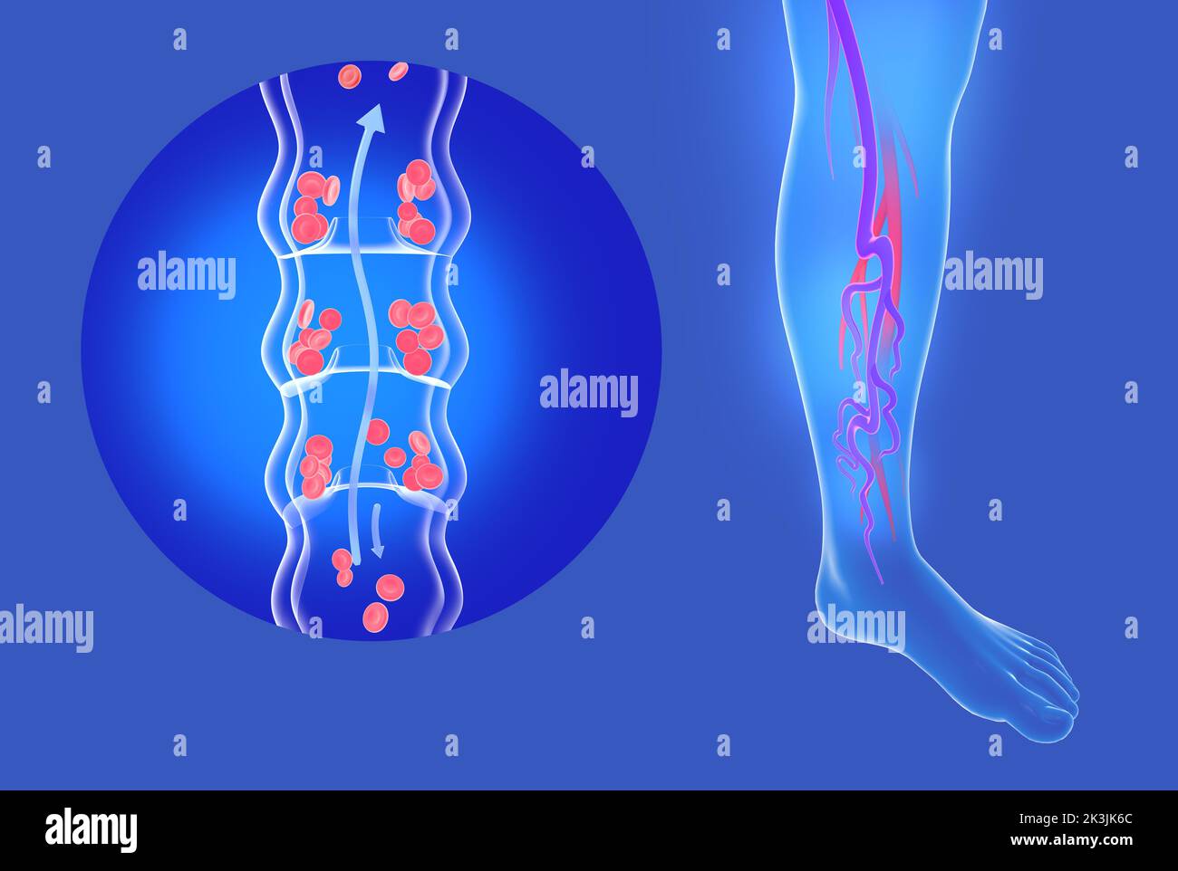 Anatomische 3D Darstellung von inkompetenten Venen und Krampfadern in den Beinen. Transparentes Kreislaufsystem der Venen. Stockfoto