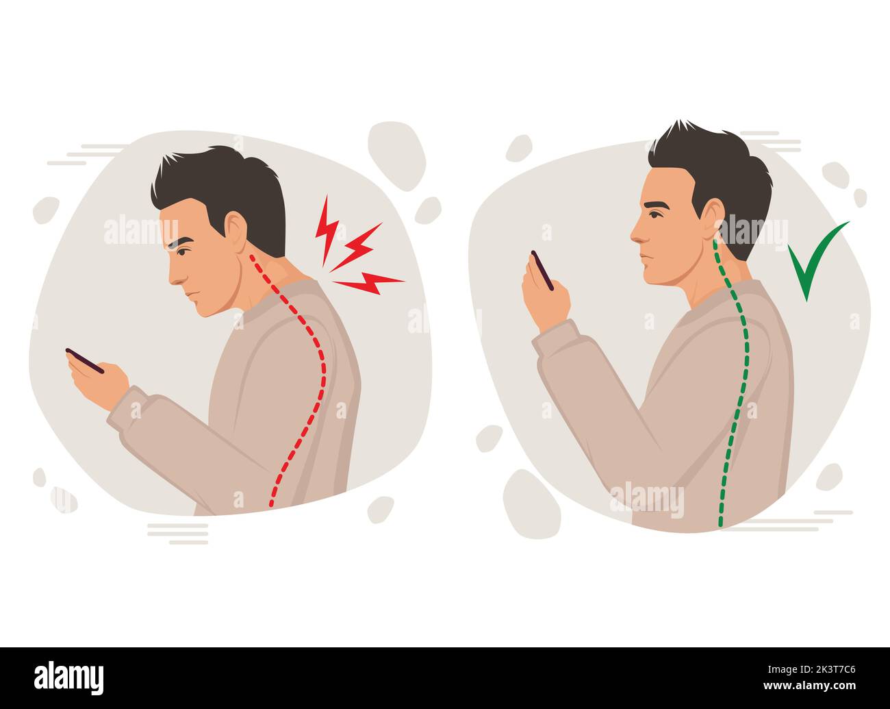 Körperhaltung Vektor-Illustration, falscher Kopfwinkel mit dem Telefon, schlechte Haltung, Rückenschmerzen, Schulterschmerzen, Krümmung der Wirbelsäule, falsche Haltung Stock Vektor