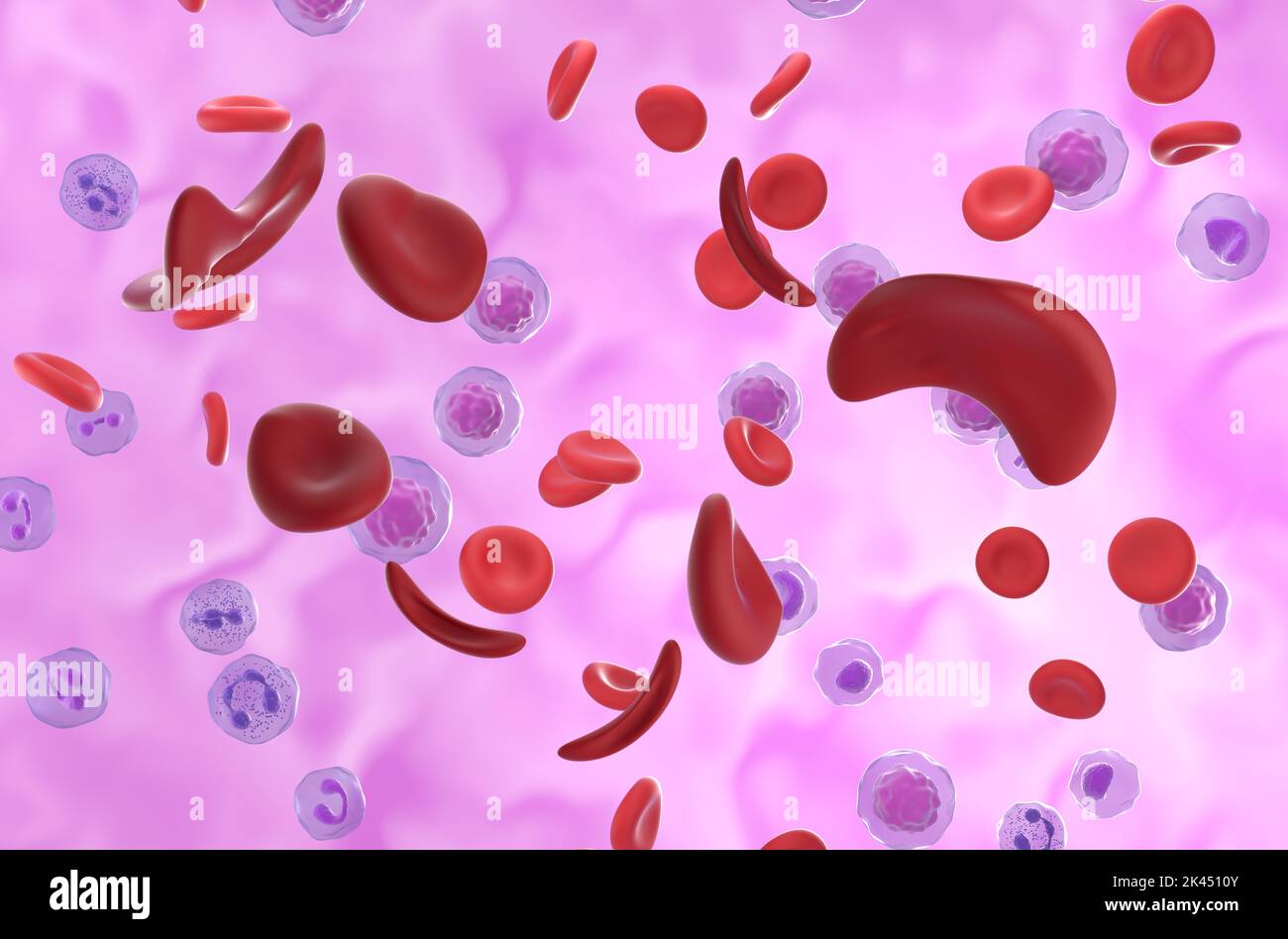 Sichelzellanämie (Sichelzellanämie SCD) Zellen im Blutfluss - isometrische Ansicht 3D Abbildung Stockfoto
