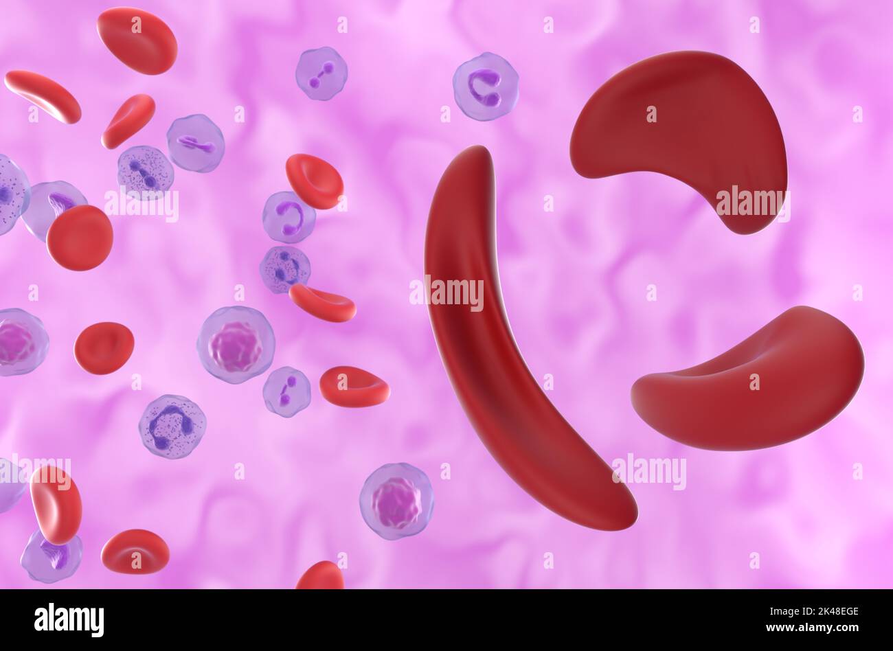 Sichelzellanämie (Sichelzellanämie SCD) Zellen im Blutfluss - isometrische Ansicht 3D Abbildung Stockfoto
