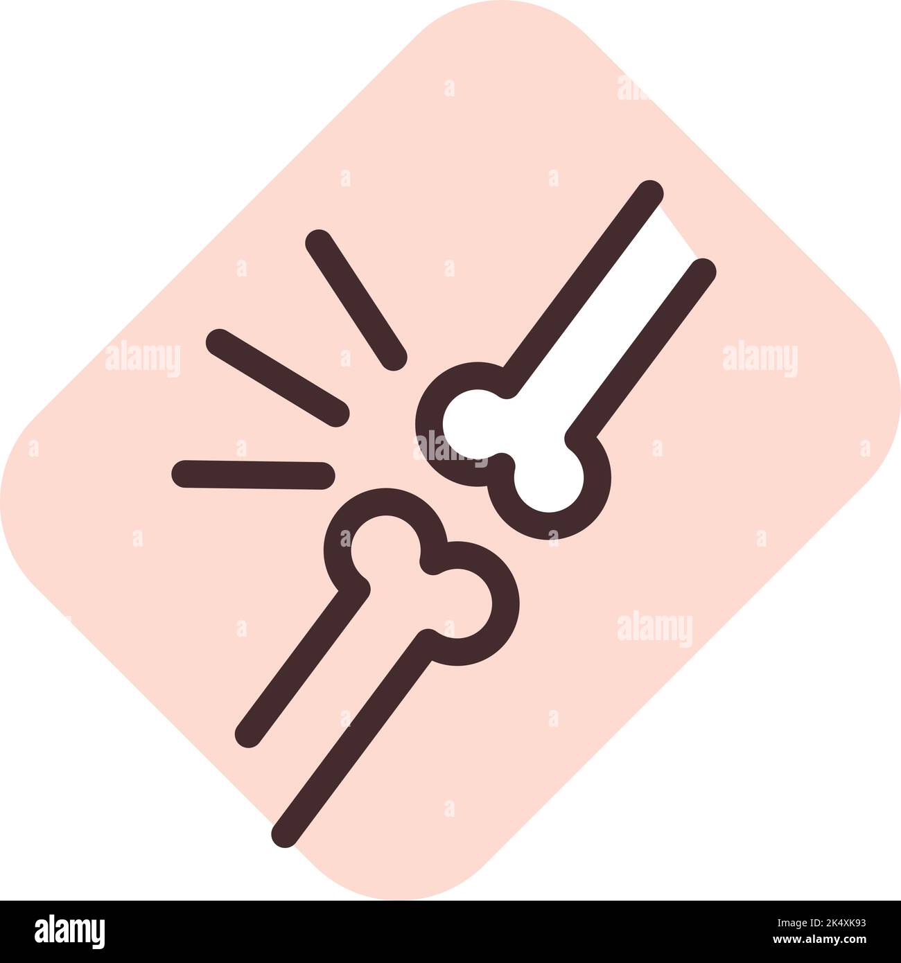 Knochenarthritis, Illustration, Vektor auf weißem Hintergrund. Stock Vektor