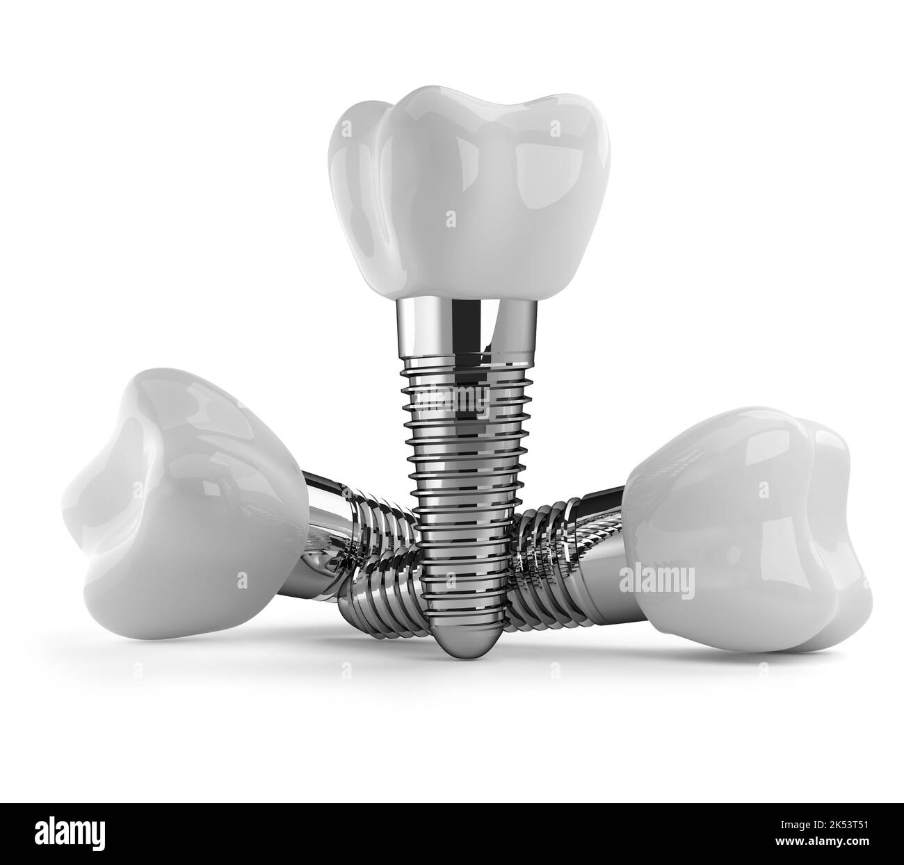Zahnimplantate isoliert auf weißem Hintergrund.3D Rendering. Stockfoto