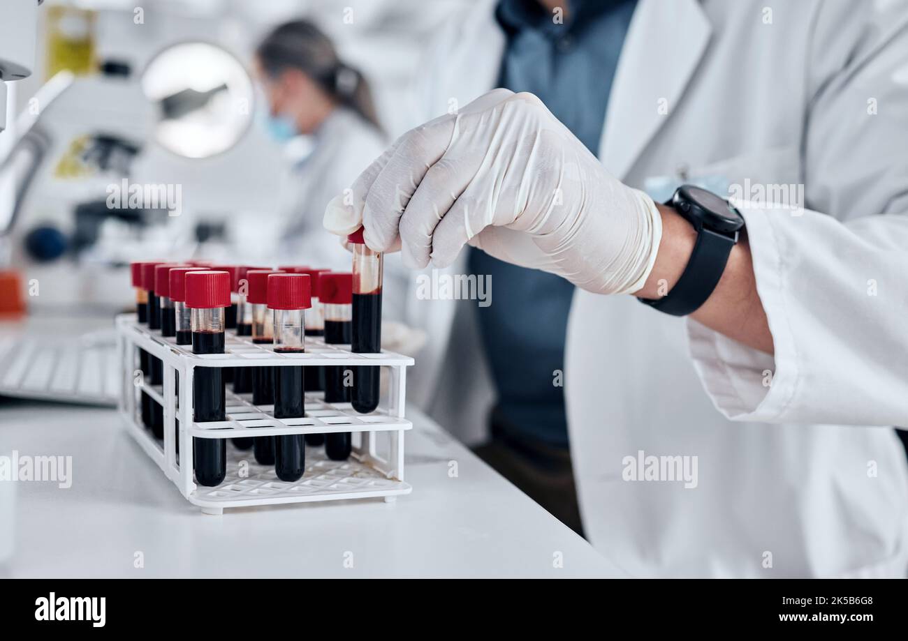 Wissenschaftler, Wissenschaft und dna-Blutproben-Reagenzglas im Pathologielabor mit Handschuhen, die Forschung betreiben und an Impfstoffen oder medizinischen Untersuchungen arbeiten Stockfoto