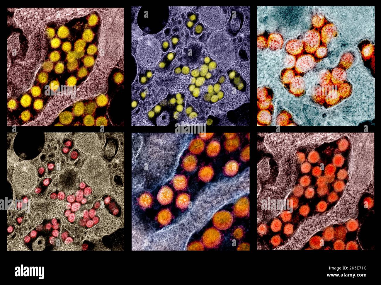 Eine Zusammenstellung von Bildern des neuartigen Coronavirus SARS-CoV-2. Transmissionselektronenmikroskope von SARS-CoV-2-Viruspartikeln, isoliert von einem Patienten. Eine optimierte und verbesserte, einzigartige Composite-Version von sechs Rasterelektronenmikrographen-Bildern, Quelle: NIAID Stockfoto