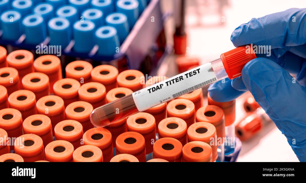 Tdap Titer Reagenzglas mit Blutprobe im Infektionslabor Stockfoto