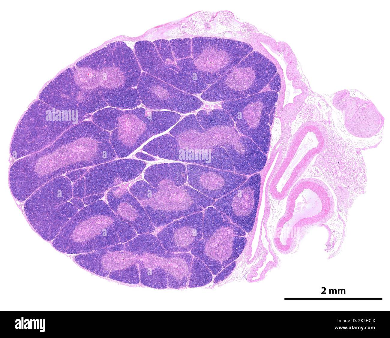 Mikroskopmikroskop mit geringer Leistung, der einen jungen Thymus zeigt. Die Organisation in Lobbies ist deutlich zu sehen. In jedem Webel ist die periphere Kortex App Stockfoto
