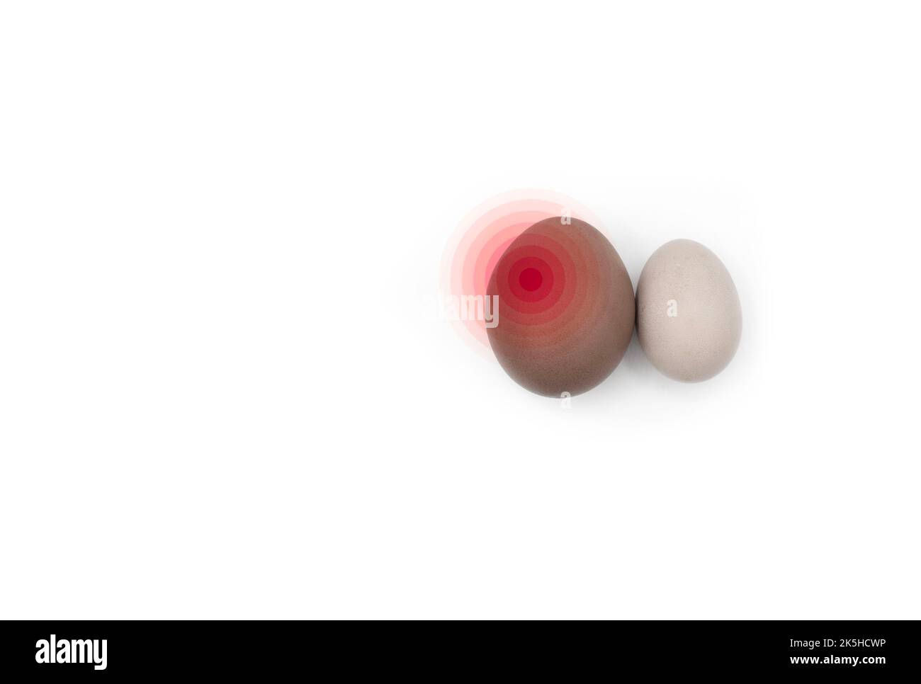 Konzept der rechtsseitigen Skrotalschwellung oder Hodenschmerzen. Mit Textbereich. Isoliert auf Weiß. Stockfoto