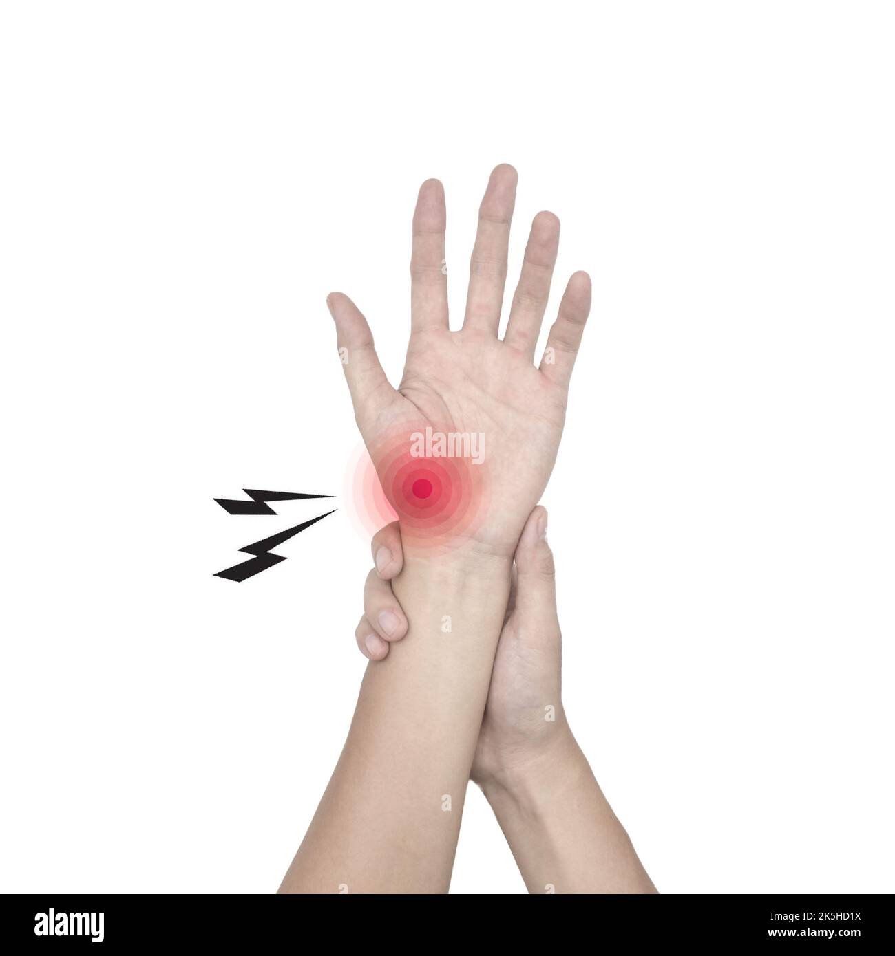 Schmerzen an der Basis des Daumens. Ursachen können Verletzungen oder Übernutzung, Arthrose des Basalgelenks oder Karpaltunnelsyndrom sein. Stockfoto