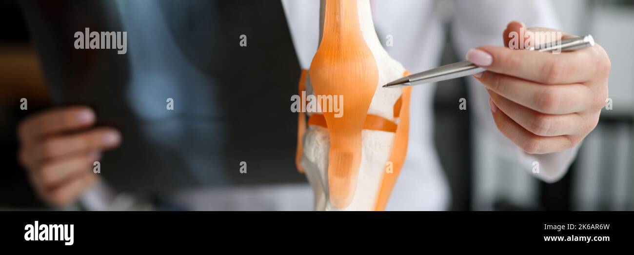 Arzt mit Röntgenaufnahme in den Händen, die die Struktur des Kniegelenks auf einer künstlichen Nahaufnahme zeigt Stockfoto
