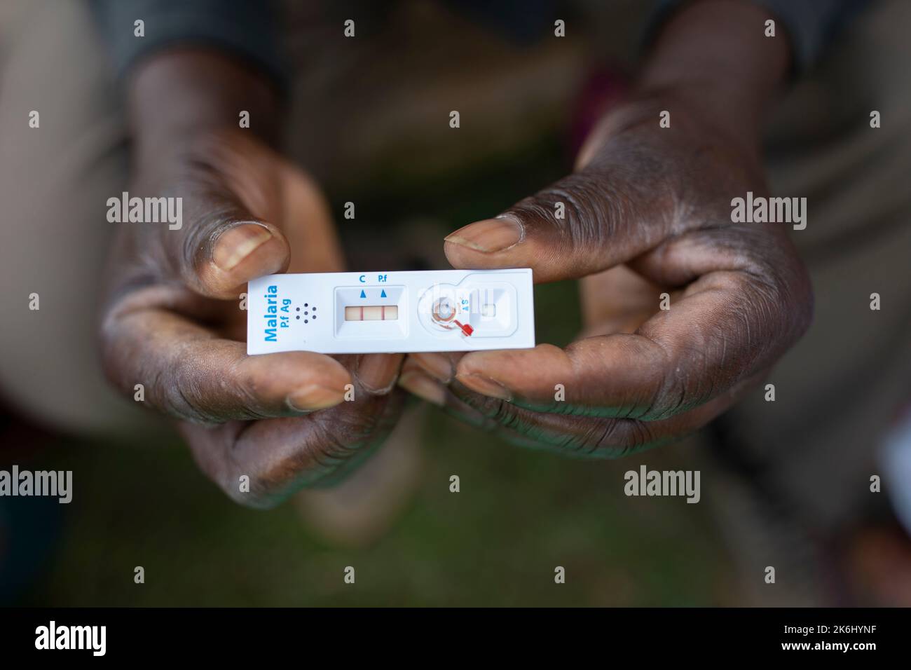 Ein Paar Hände hält einen positiven Malaria-Schnelltest in Uganda, Ostafrika. Stockfoto