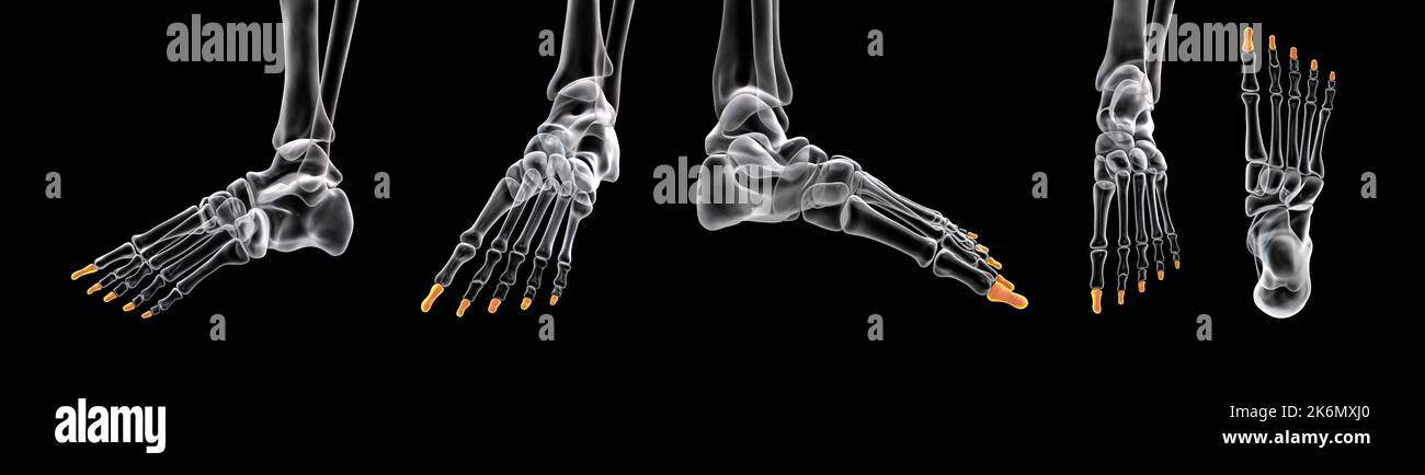 Distale Knochen des Fußes, Abbildung Stockfoto