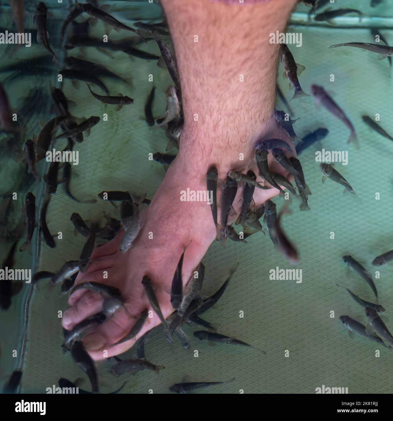 Gara Rufa Arzt Fisch behandeln menschliche Beinhaut im Wasserbehälter Stockfoto