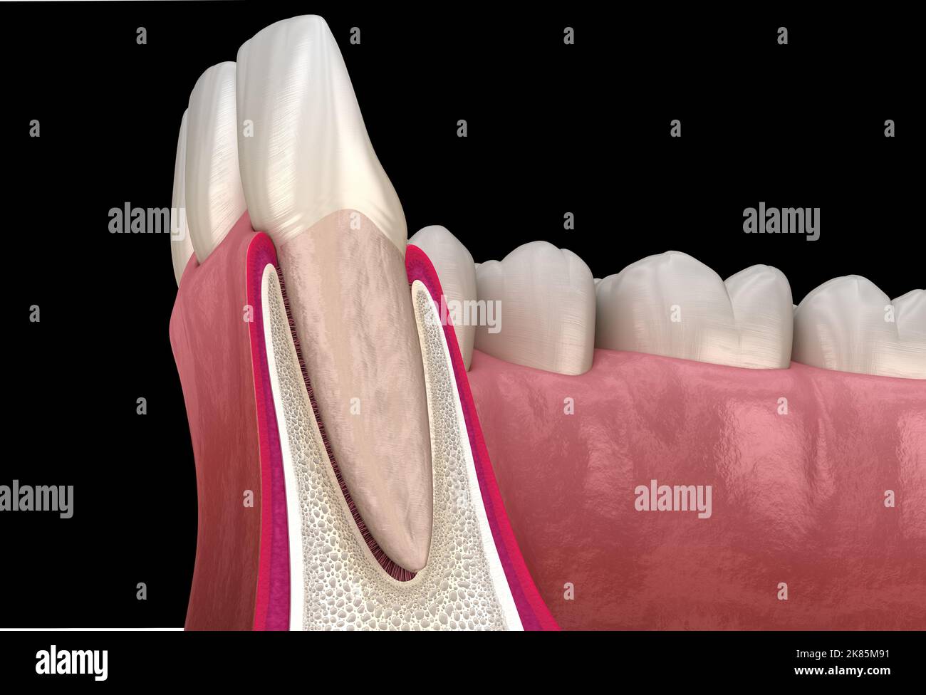 Morphologie des lateralen Schneidezahn und des Zahnfleisches im Oberkiefer. Medizinisch genaue zahnärztliche 3D Illustration Stockfoto