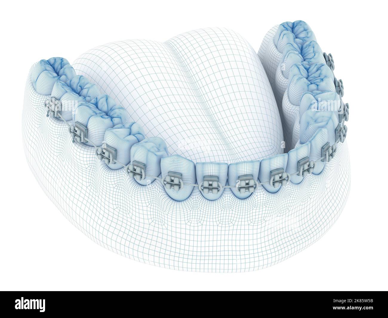 Zahnspange und Prothese. Abbildung des Modells Draht 3D Stockfoto