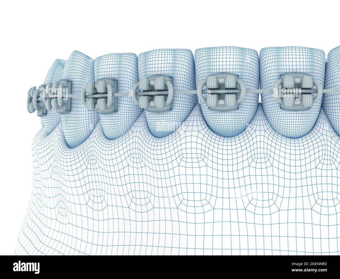 Zahnspange und Prothese. Abbildung des Modells Draht 3D Stockfoto