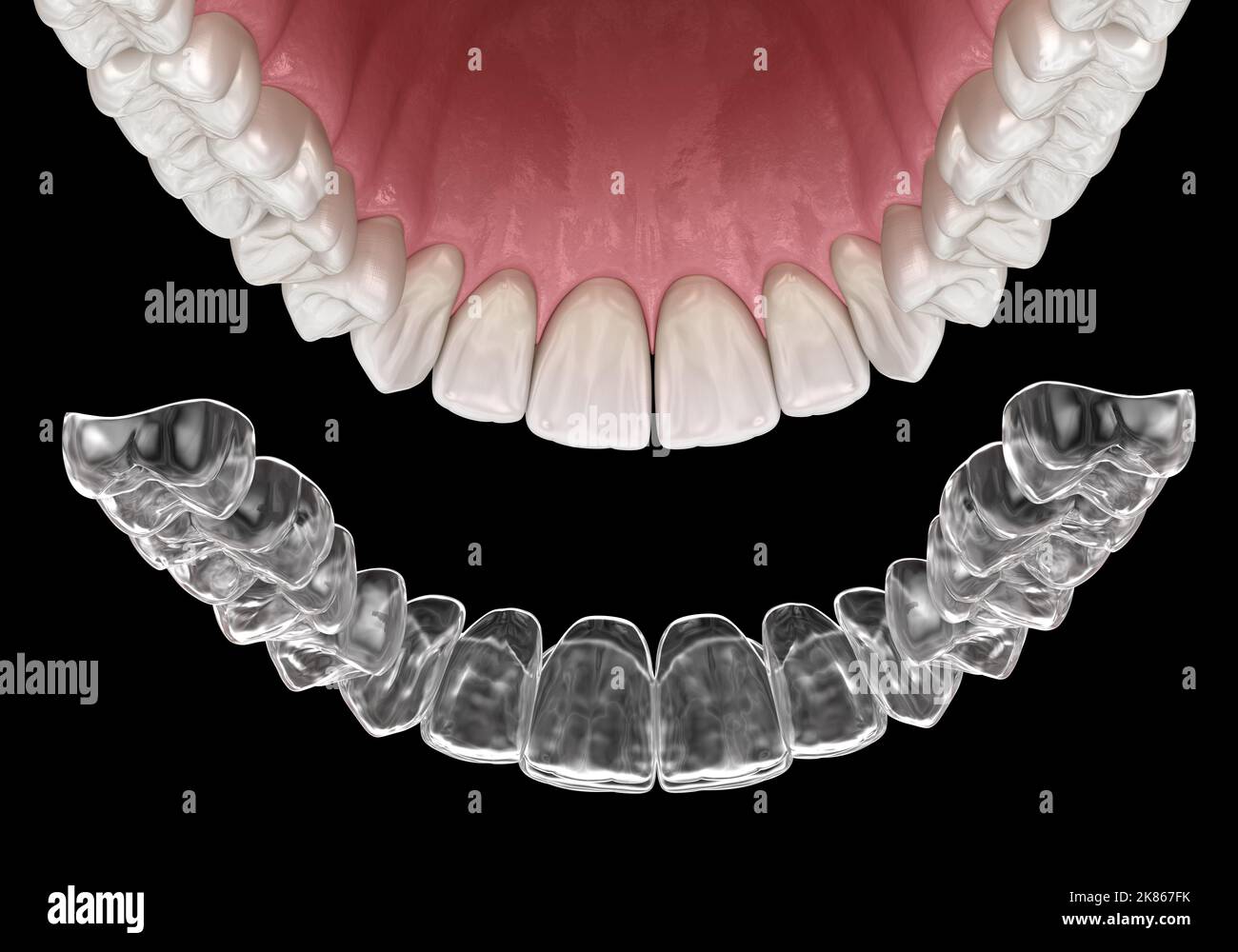 Invisalign-Klammern oder unsichtbare Halterung. Medizinisch genaue zahnärztliche 3D Illustration Stockfoto