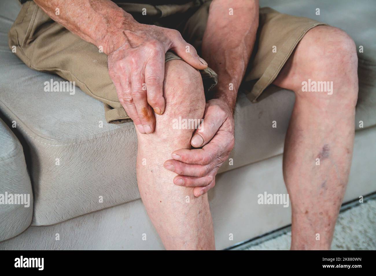 Schmerzen in den Beinen und Knien eines älteren Senioren Stockfoto