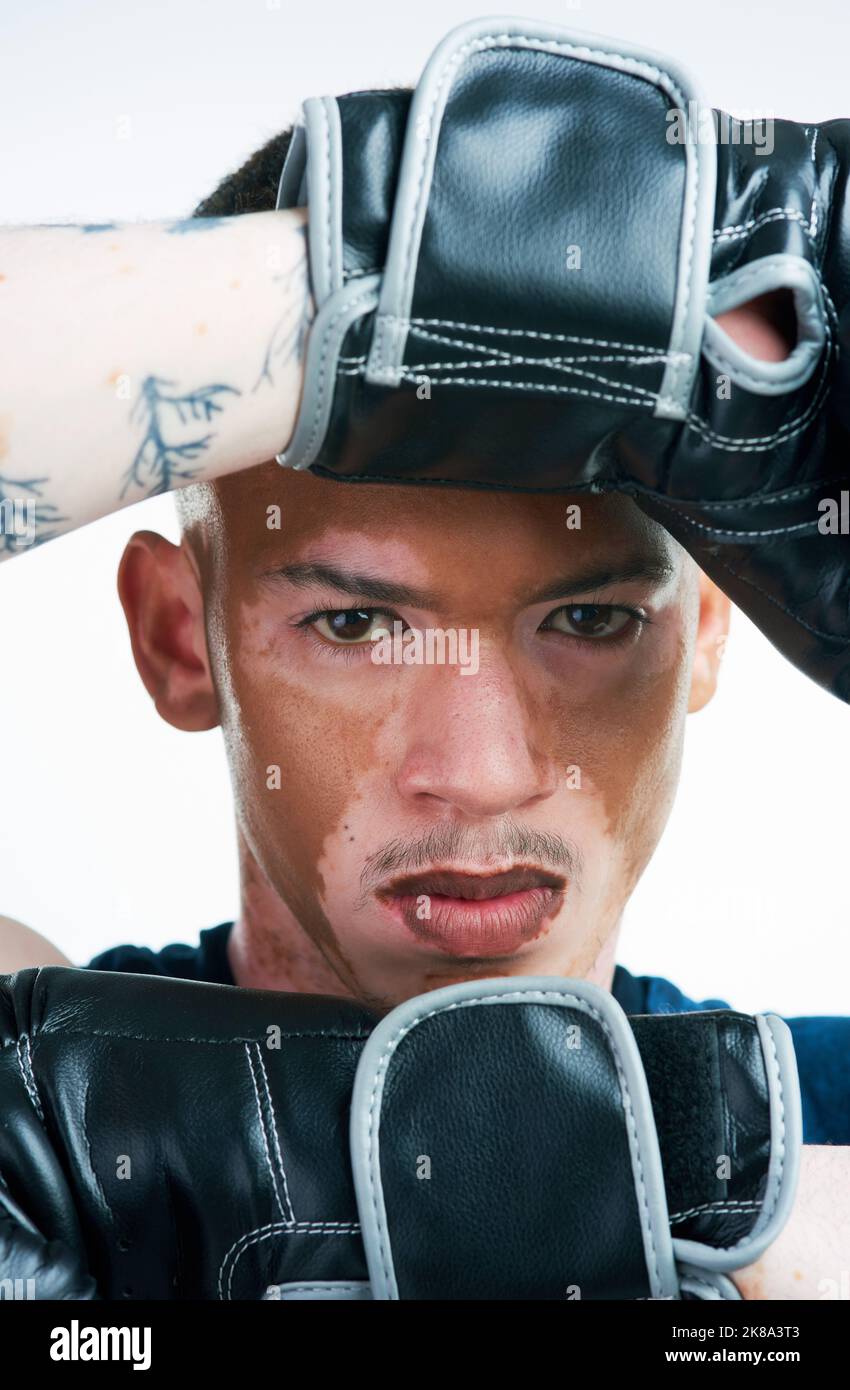 Wenn du hart übst, kannst du jeden Kampf gewinnen. Zugeschnittenes Porträt eines hübschen jungen Boxers mit Vitiligo, der im Studio posiert. Stockfoto