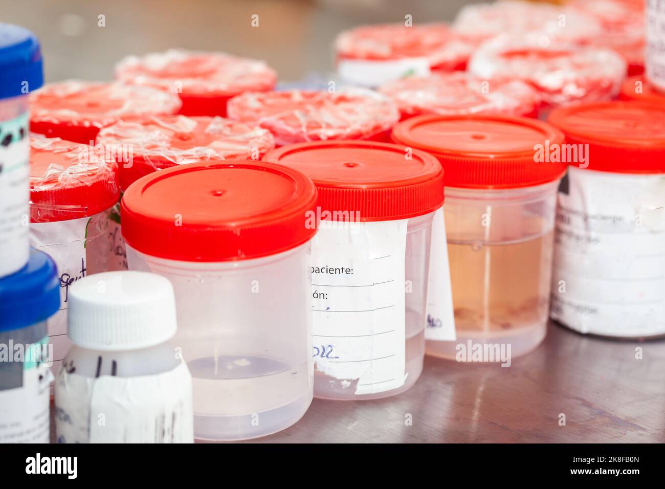 Sterile medizinische Behälter mit Biopsieproben, die zur Analyse bei der Pathologie verarbeitet werden können. Konzept zur Krebsdiagnose. Medizinisches Konzept. Stockfoto