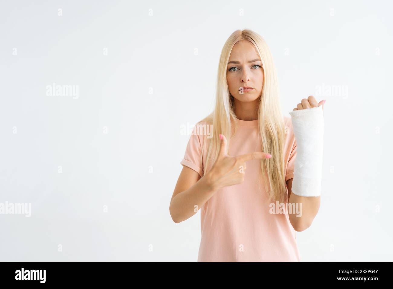 Attraktive, traurige, blonde junge Frau zeigt Zeigefinger auf einen gebrochenen Arm, eingewickelt in einen Gipsverband und schaut auf die Kamera, isoliert auf weißem Stand Stockfoto