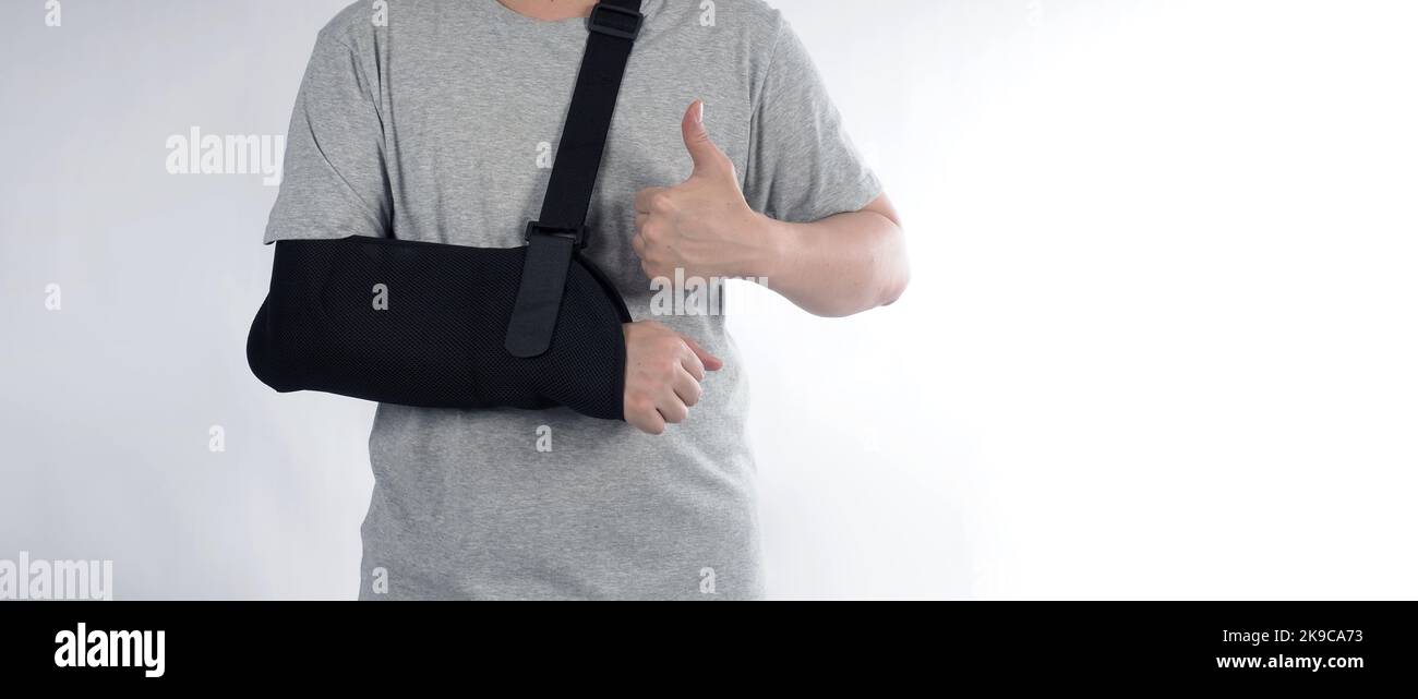 Gebrochener Arm. Arm Sling Therapie Unterstützung und um den Ellbogen bedeckt ersten Knöchel gebrochenen Arm. Postoperative Pflege. Frakturen des Humerus Radius ulna scapula Stockfoto