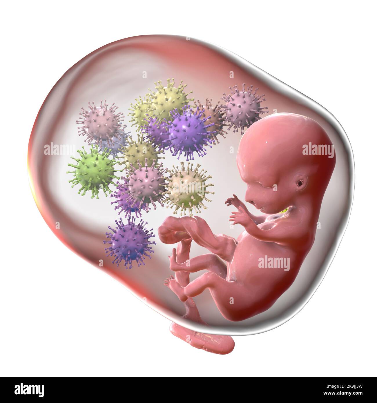 Transplazentäre Übertragung des Cytomegalovirus, Illustration Stockfoto