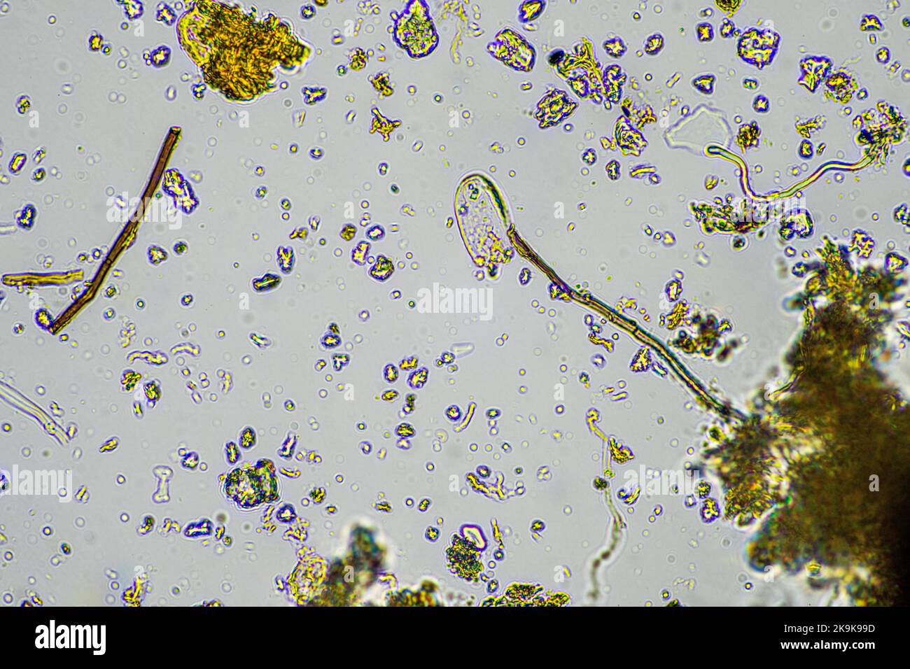 Pilz- und Pilzhyphen unter dem Mikroskop im Boden und Kompost, bei einem  Bodenbiologie- und Mikroorganismentest in Australien im Frühjahr  Stockfotografie - Alamy