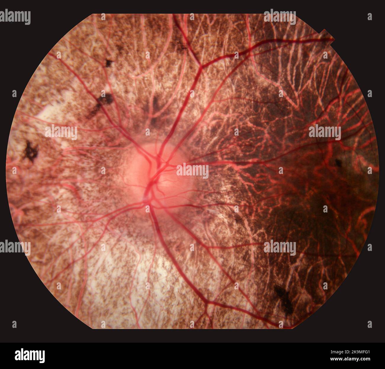 Fotografie der menschlichen Augenretina Stockfoto