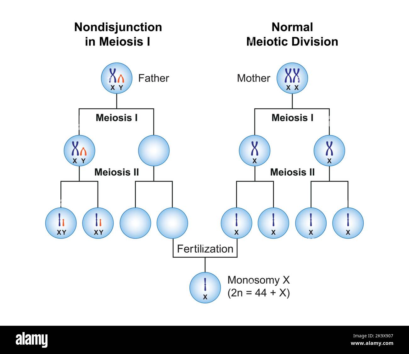 Wissenschaftliche Entwicklung von Nondisjunction bei Monosomie X (Turner-Syndrom) . Bunte Symbole. Vektorgrafik. Stock Vektor