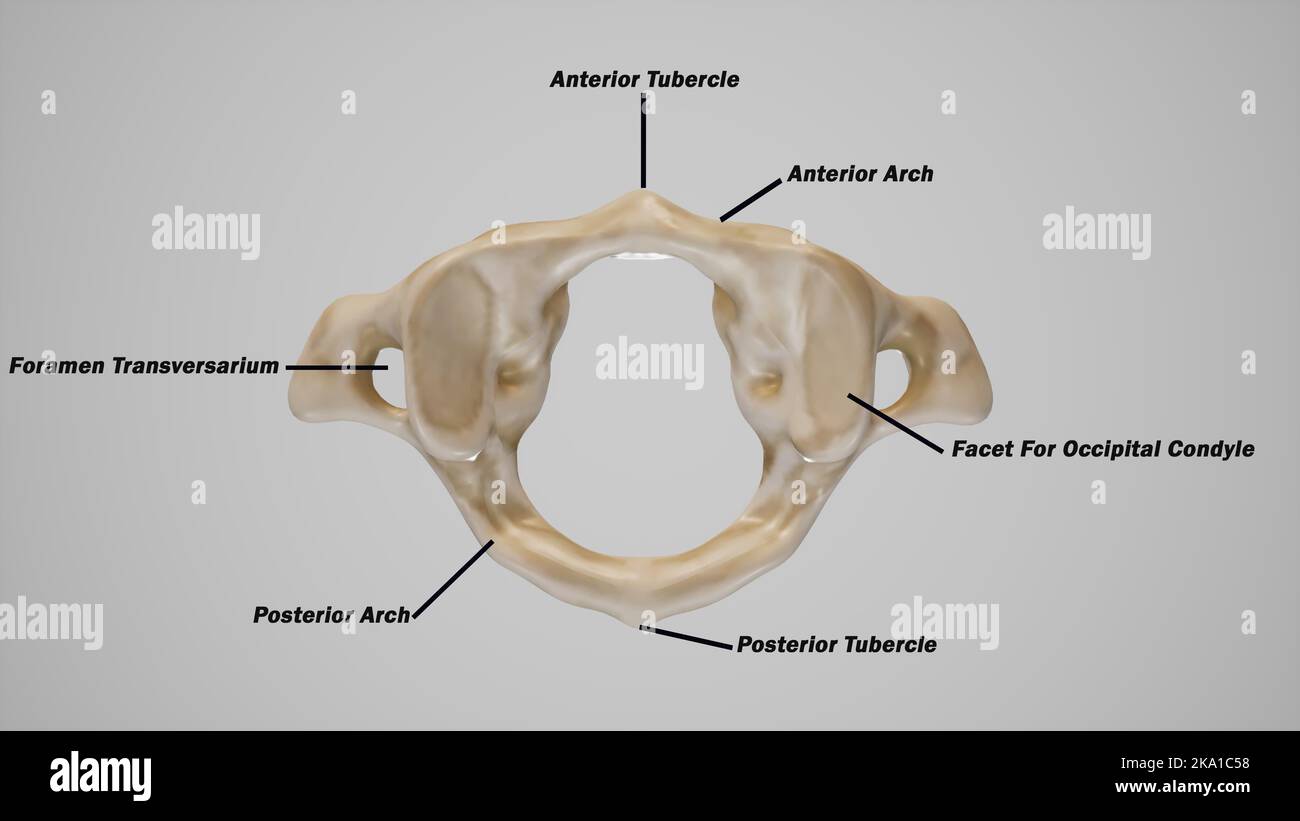 Halswirbelsäule, erster Halswirbel (Atlas) – bessere Ansicht markiert Stockfoto
