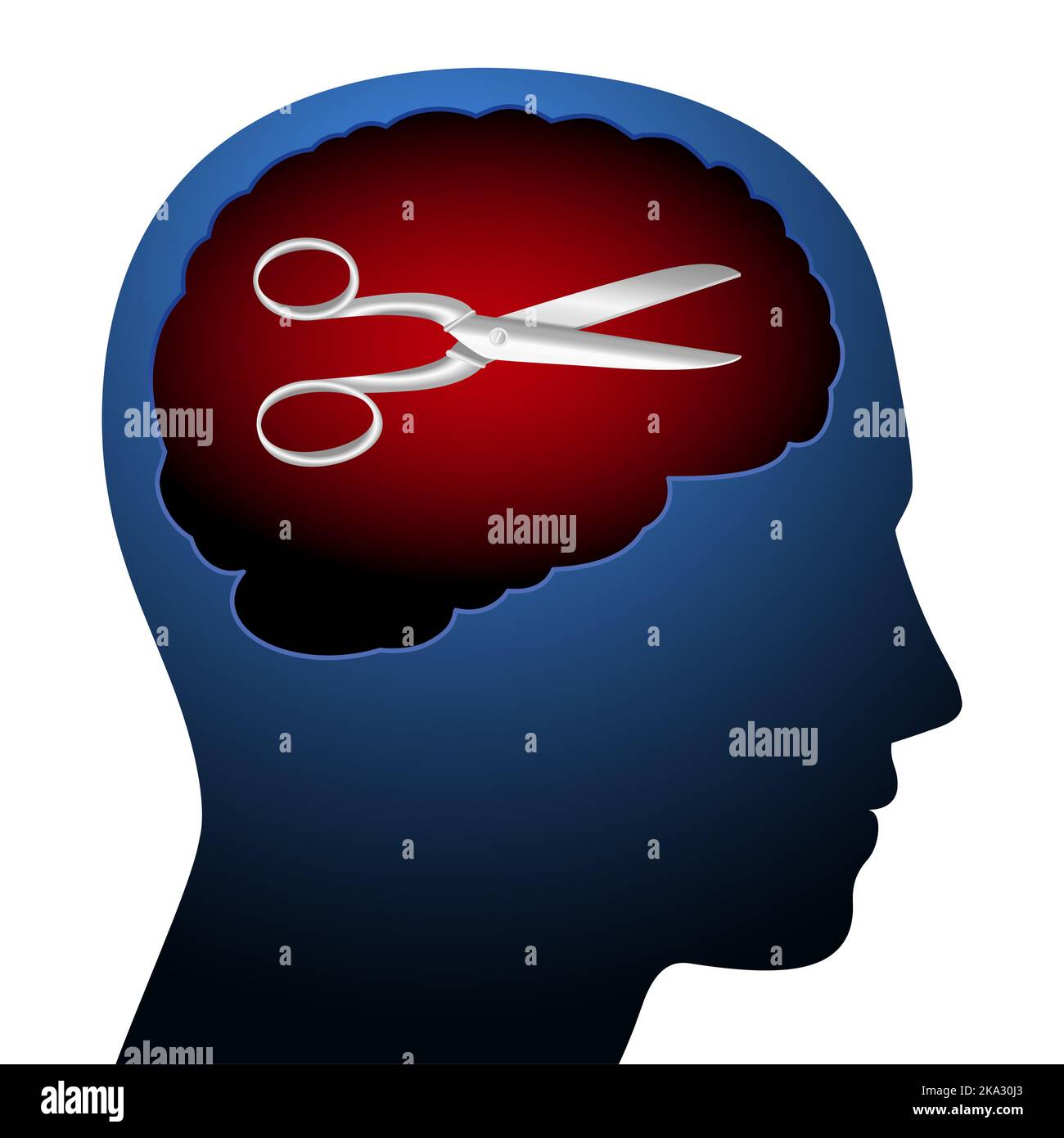 Die Schere im Kopf, Symbol für Selbstzensur. Metapher, die im deutschsprachigen Raum für den Akt der Zensur oder Klassifizierung des eigenen Diskurses verwendet wird. Stockfoto